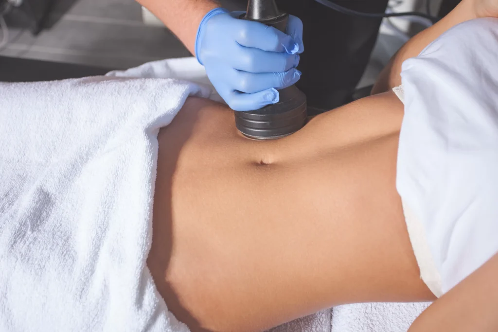 Non-Surgical Body Contouring