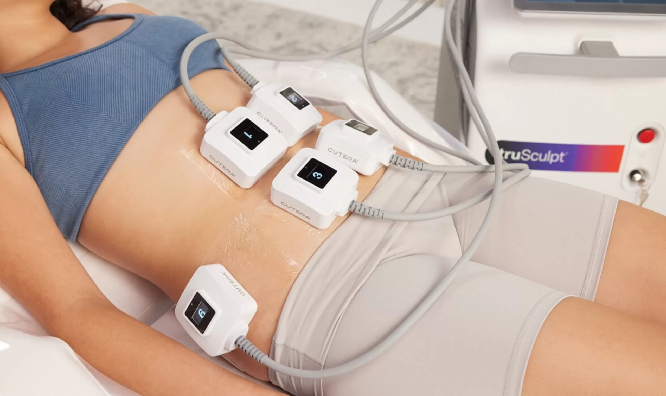 truSculpt Body Contouring Edmonton