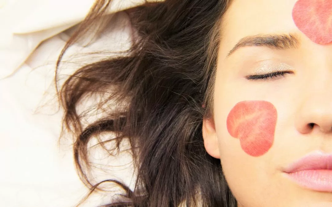 Rosacea